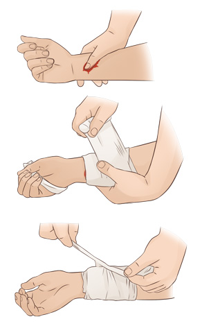 första hjälpen kurs i stockholm