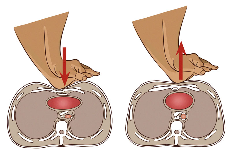 30:2 mitt på, hur gör man HLR